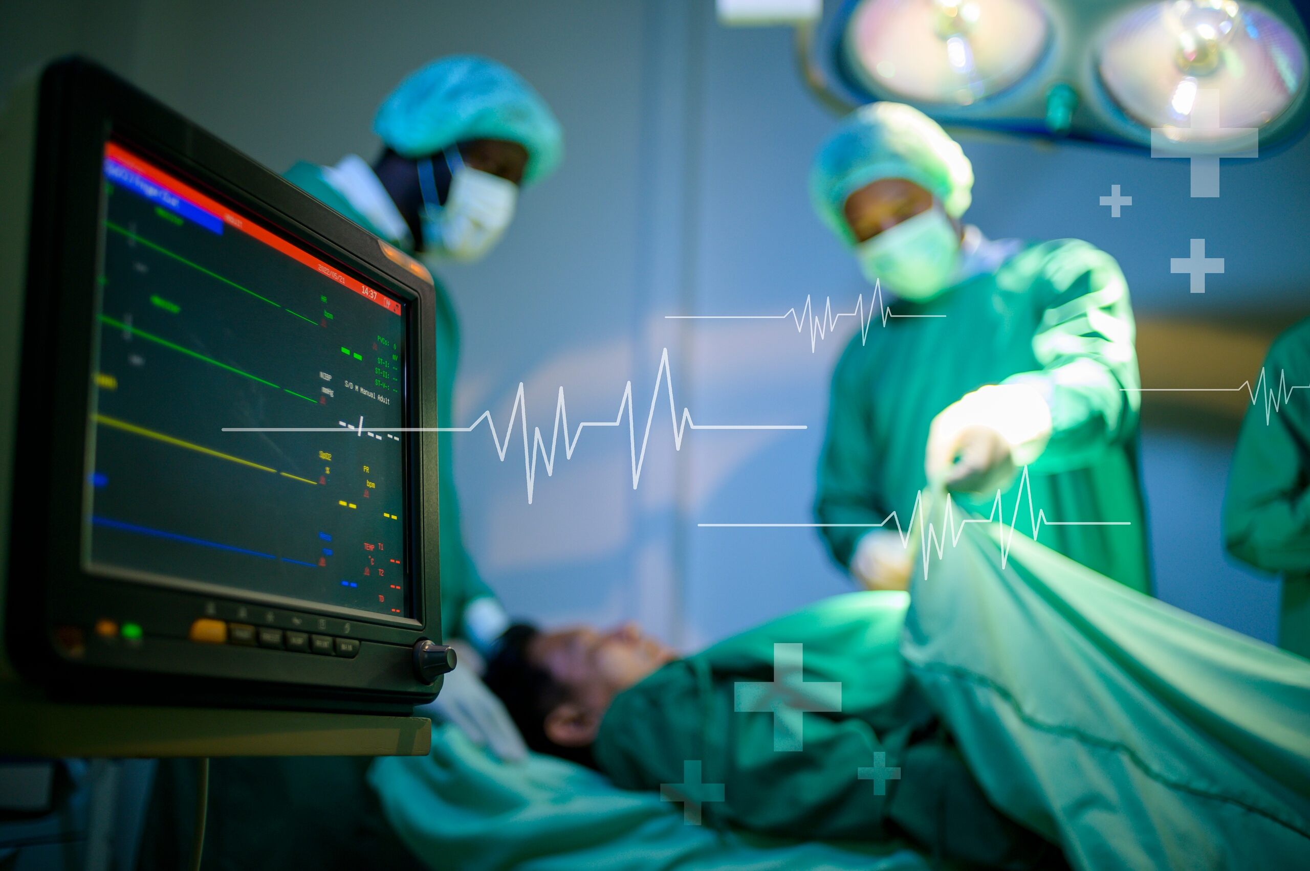 A medical monitor displays vital signs in the foreground while a surgical team in scrubs works on a patient in an operating room.